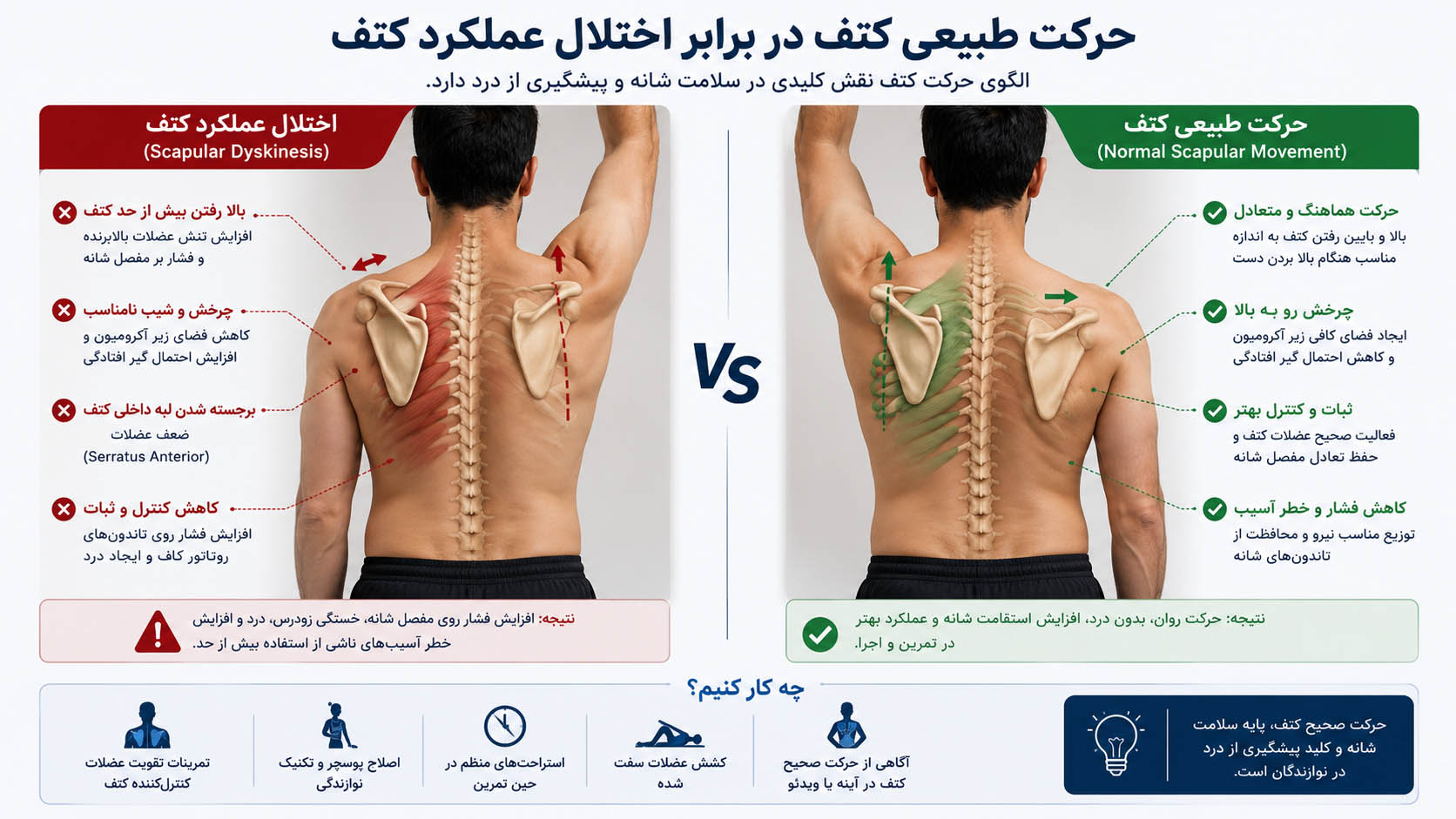 اختلال عملکرد کتف نوازندگان